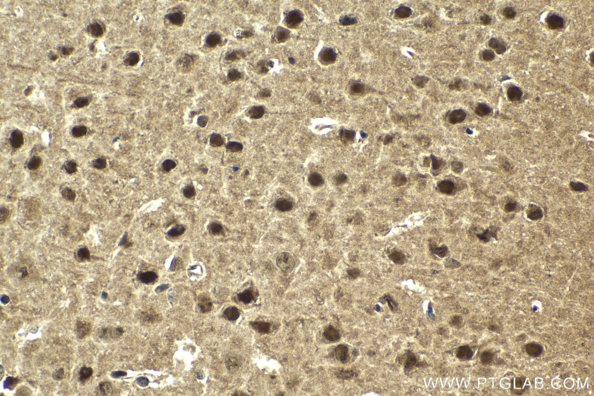 Immunohistochemical analysis of paraffin-embedded mouse brain tissue slide using KHC2042 (PSMD12 IHC Kit).