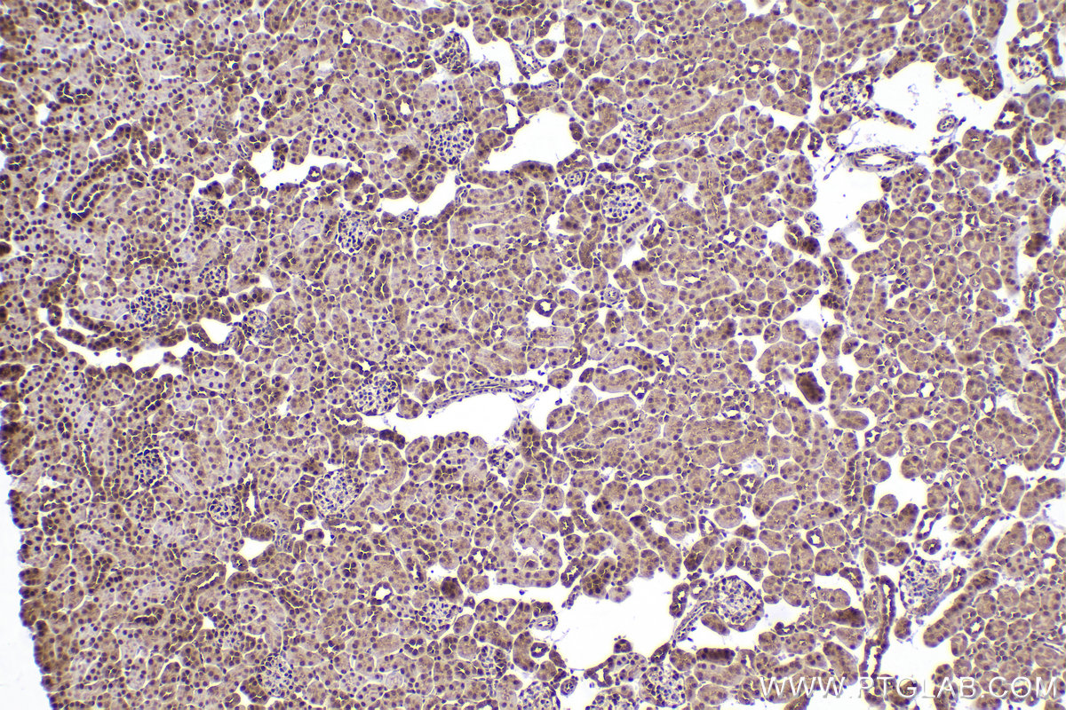 Immunohistochemical analysis of paraffin-embedded mouse kidney tissue slide using KHC2423 (PSMD2 IHC Kit).