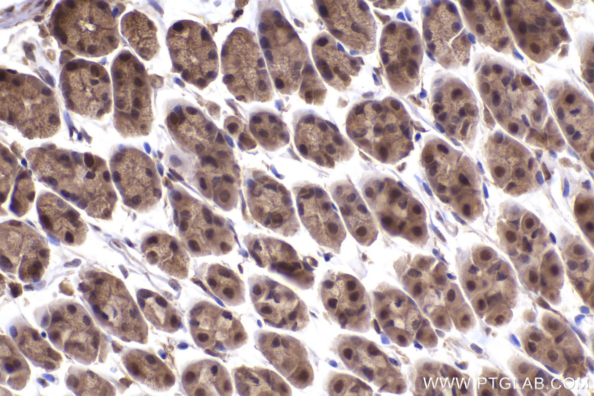 Immunohistochemical analysis of paraffin-embedded mouse stomach tissue slide using KHC2423 (PSMD2 IHC Kit).