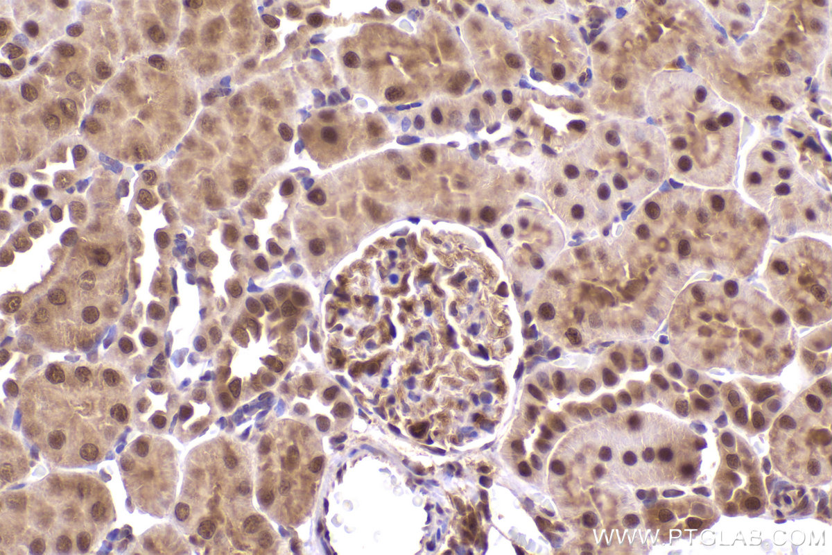 Immunohistochemical analysis of paraffin-embedded rat kidney tissue slide using KHC2423 (PSMD2 IHC Kit).