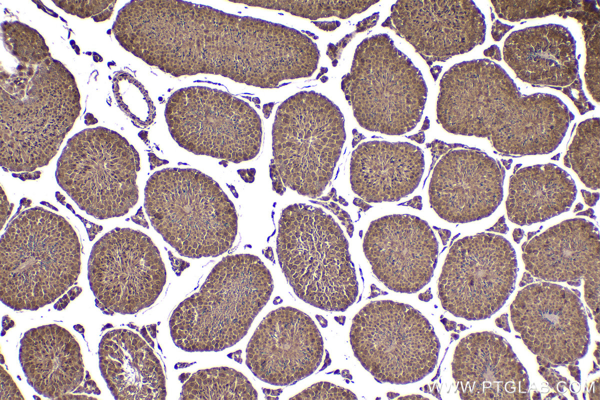 Immunohistochemical analysis of paraffin-embedded mouse testis tissue slide using KHC2075 (PSMD3 IHC Kit).