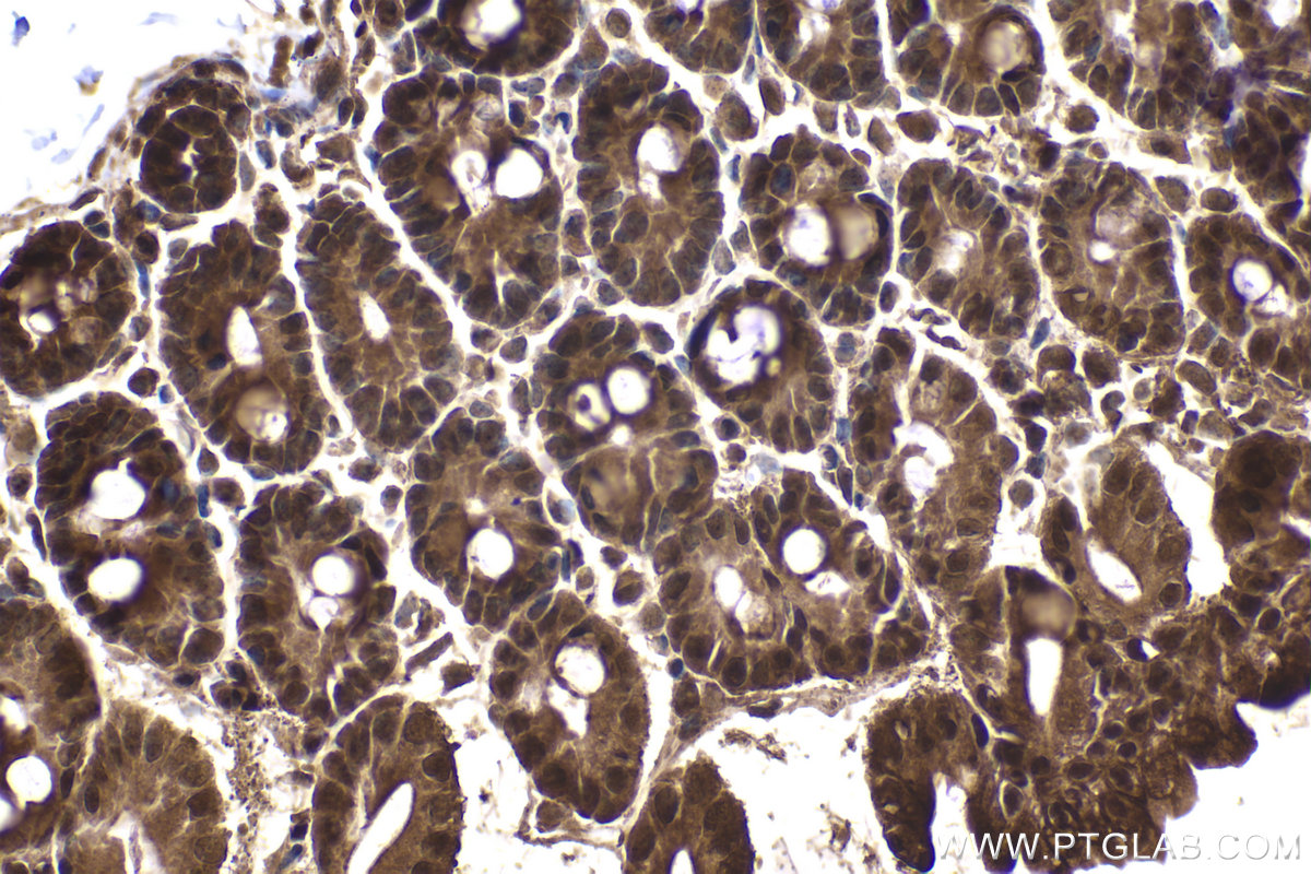 Immunohistochemical analysis of paraffin-embedded mouse small intestine tissue slide using KHC2075 (PSMD3 IHC Kit).