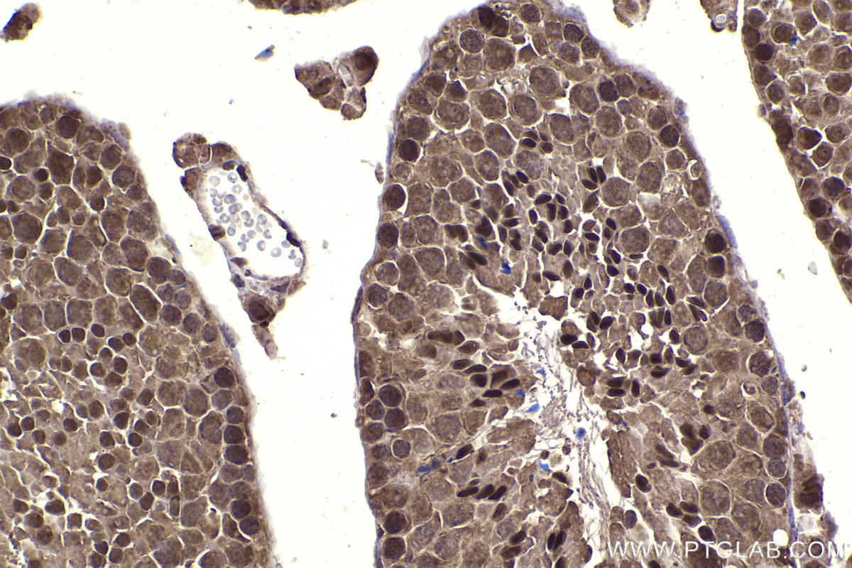 Immunohistochemical analysis of paraffin-embedded mouse testis tissue slide using KHC2328 (PSMD4 IHC Kit).