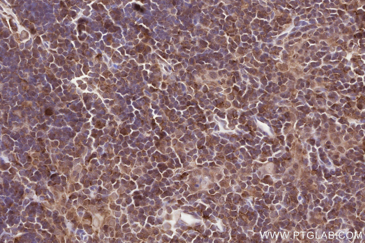 Immunohistochemical analysis of paraffin-embedded mouse thymus tissue slide using KHC2589 (PSRC1 IHC Kit).