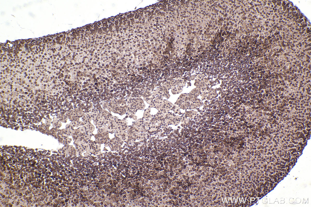 Immunohistochemical analysis of paraffin-embedded mouse adrenal gland tissue slide using KHC2457 (PTK2B IHC Kit).