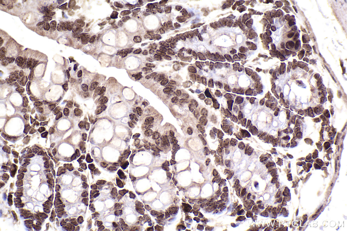 Immunohistochemical analysis of paraffin-embedded mouse colon tissue slide using KHC2457 (PTK2B IHC Kit).