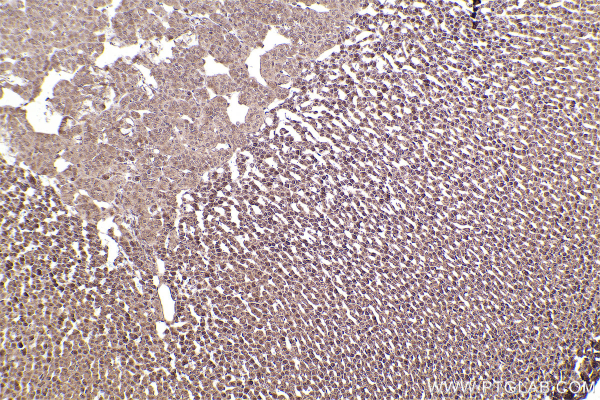 Immunohistochemical analysis of paraffin-embedded rat adrenal gland tissue slide using KHC2457 (PTK2B IHC Kit).