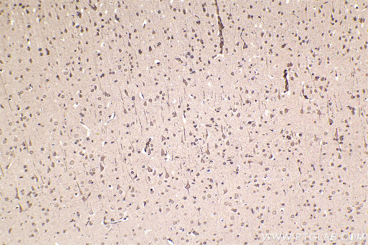 Immunohistochemical analysis of paraffin-embedded rat brain tissue slide using KHC2457 (PTK2B IHC Kit).