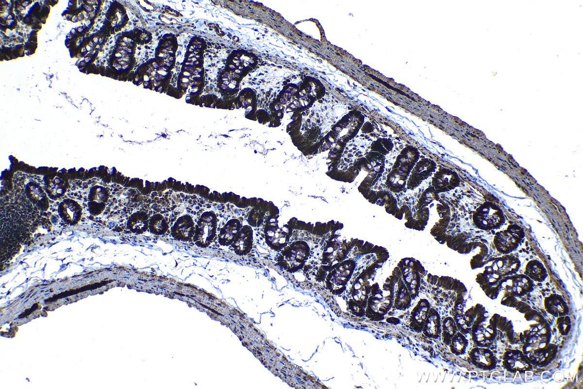 Immunohistochemical analysis of paraffin-embedded rat colon tissue slide using KHC1316 (PTPN2 IHC Kit).