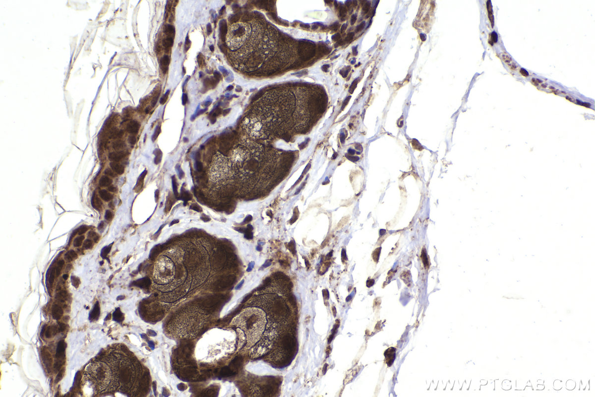 Immunohistochemical analysis of paraffin-embedded mouse skin tissue slide using KHC2221 (PTPN6 IHC Kit).