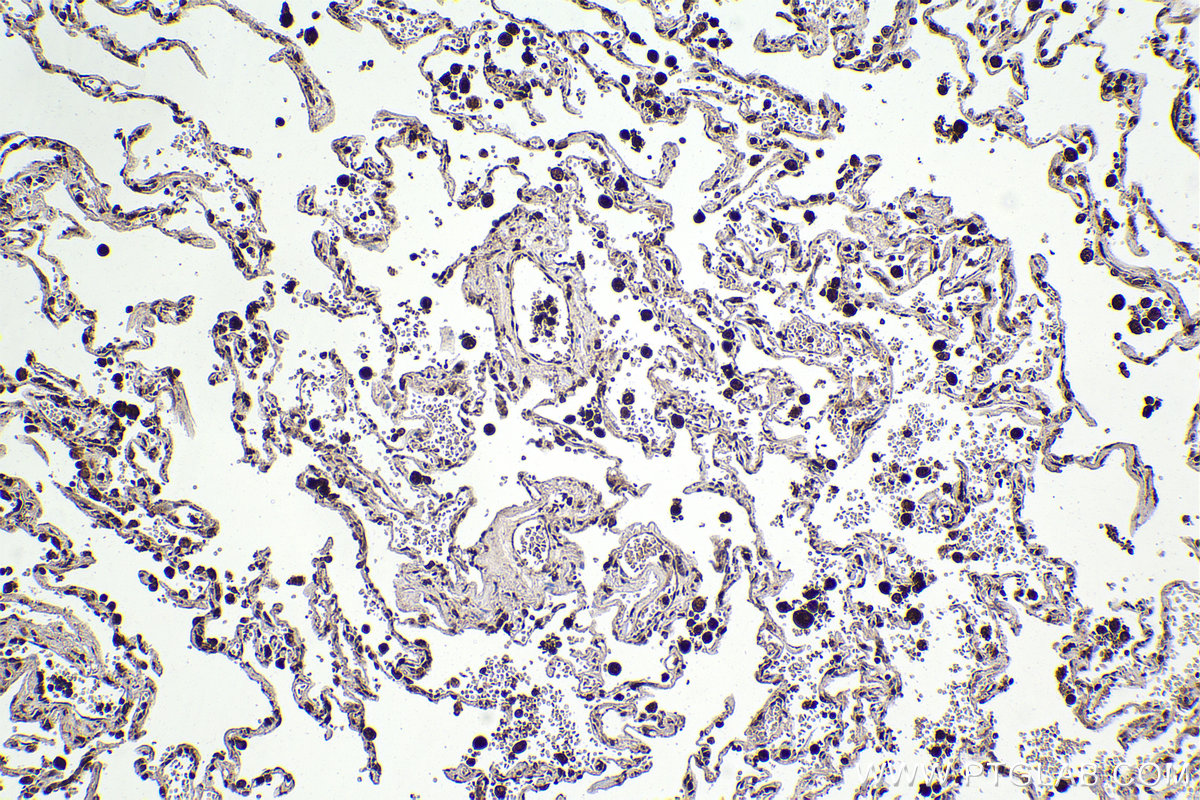 Immunohistochemical analysis of paraffin-embedded human lung tissue slide using KHC2221 (PTPN6 IHC Kit).