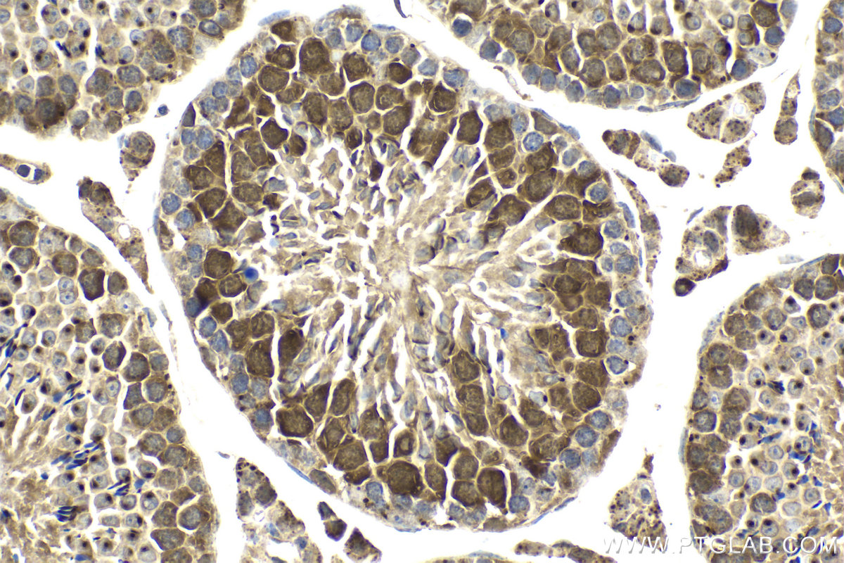 Immunohistochemical analysis of paraffin-embedded mouse testis tissue slide using KHC2152 (PTTG1/Securin IHC Kit).