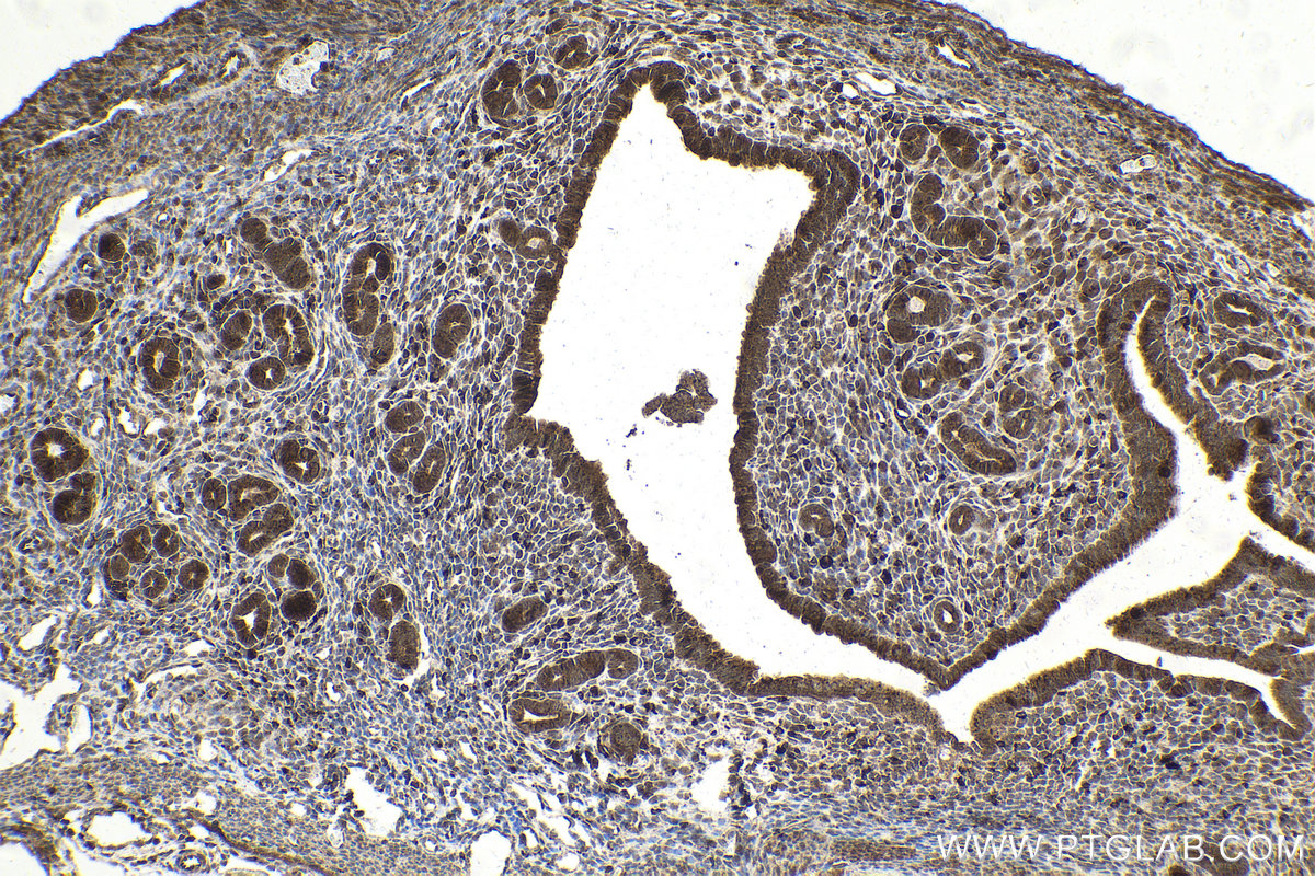 Immunohistochemical analysis of paraffin-embedded mouse cervix tissue slide using KHC2152 (PTTG1/Securin IHC Kit).