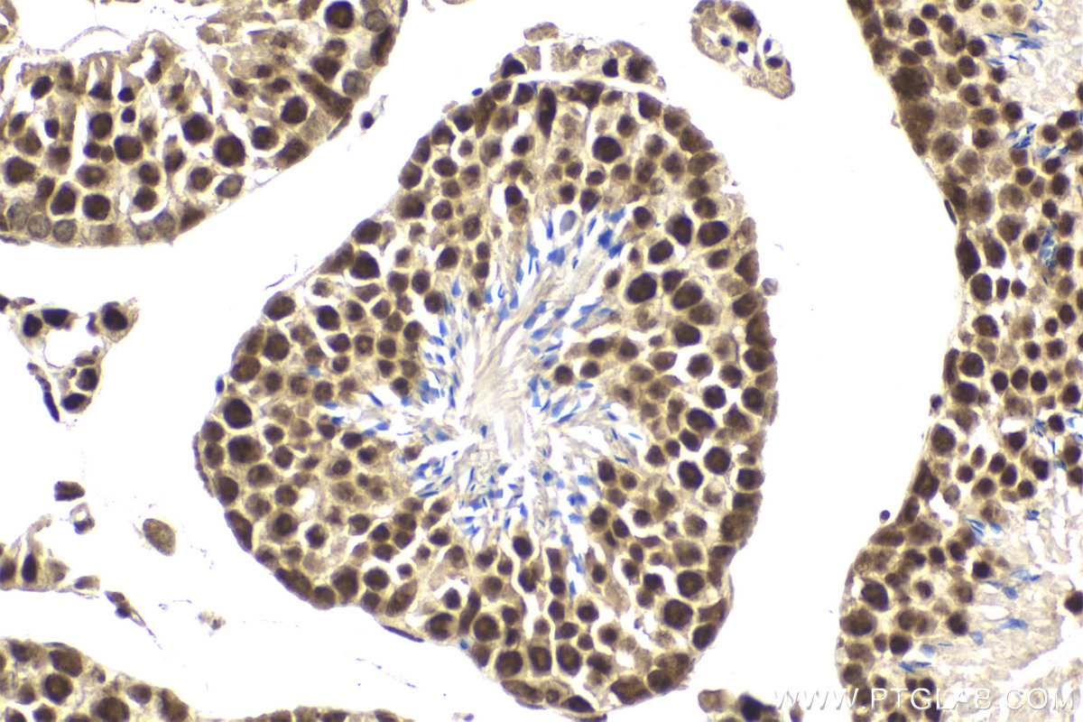 Immunohistochemical analysis of paraffin-embedded mouse testis tissue slide using KHC1985 (PUF60 IHC Kit).