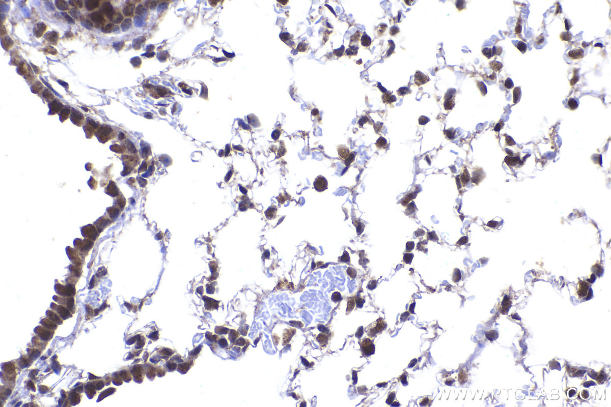 Immunohistochemical analysis of paraffin-embedded mouse lung tissue slide using KHC2244 (Prohibitin/PHB1 IHC Kit).