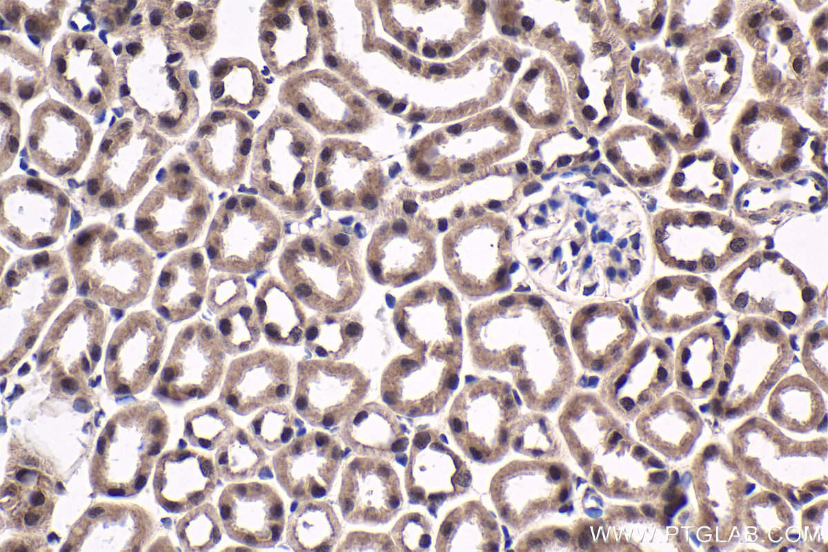 Immunohistochemical analysis of paraffin-embedded mouse kidney tissue slide using KHC1767 (QRICH1 IHC Kit).