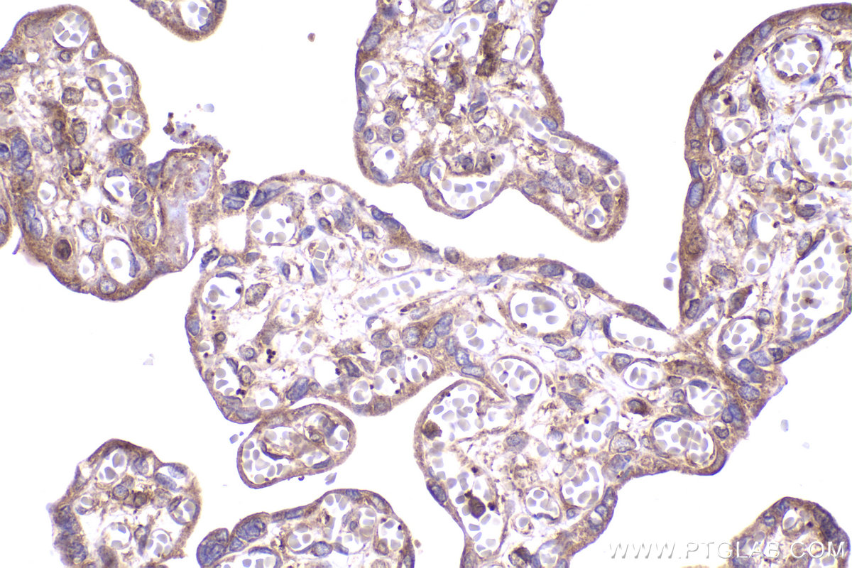 Immunohistochemical analysis of paraffin-embedded human placenta tissue slide using KHC2337 (RAB10 IHC Kit).