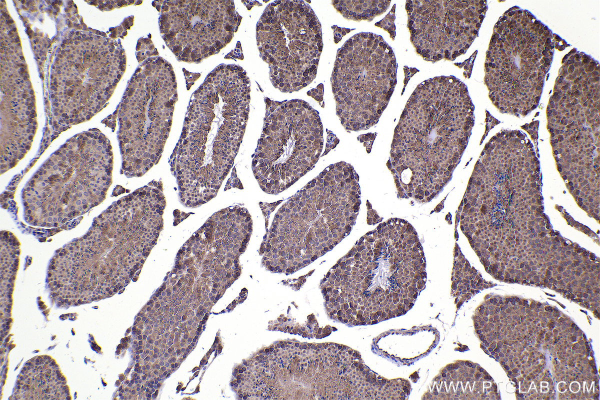 Immunohistochemical analysis of paraffin-embedded mouse testis tissue slide using KHC2351 (RAB11A/B IHC Kit).