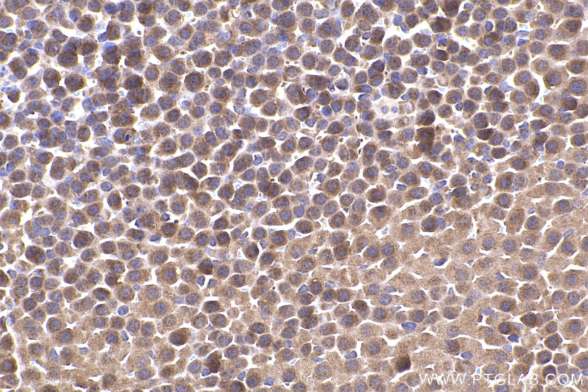 Immunohistochemical analysis of paraffin-embedded mouse adrenal gland tissue slide using KHC2351 (RAB11A/B IHC Kit).