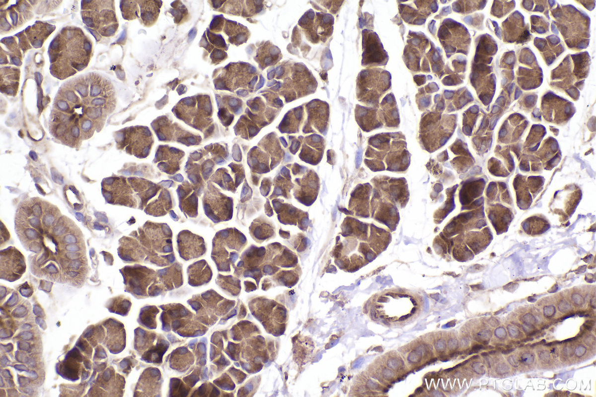 Immunohistochemical analysis of paraffin-embedded rat salivary gland tissue slide using KHC2501 (RAB11B IHC Kit).