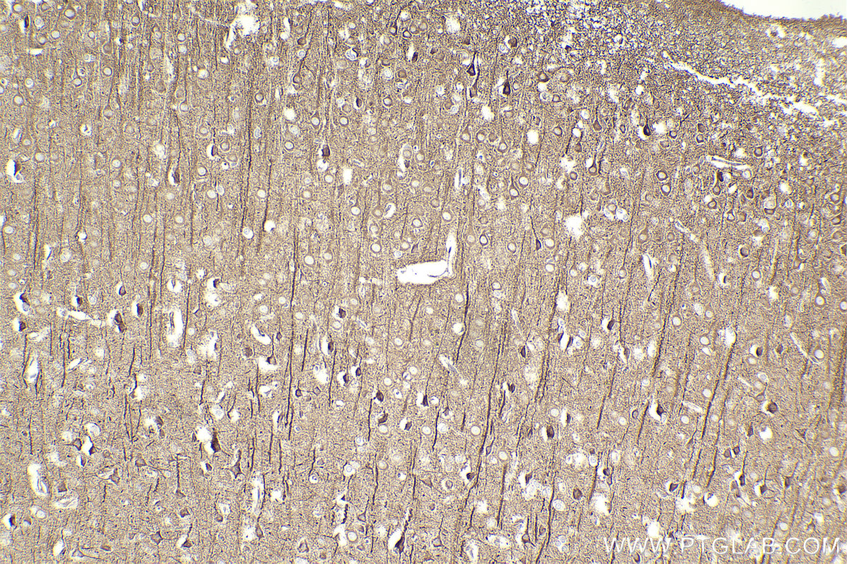 Immunohistochemical analysis of paraffin-embedded rat brain tissue slide using KHC2302 (RAB13 IHC Kit).