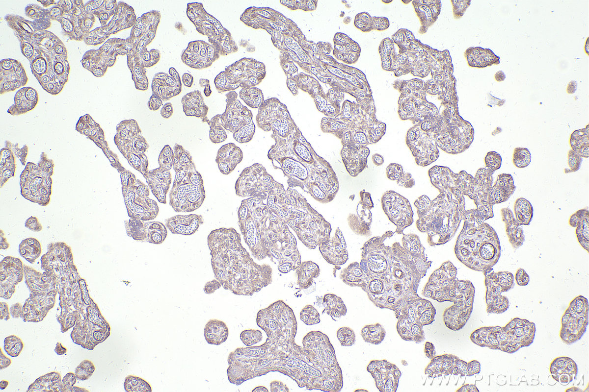 Immunohistochemical analysis of paraffin-embedded human placenta tissue slide using KHC2519 (RAB30 IHC Kit).