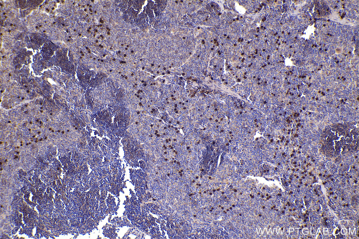 Immunohistochemical analysis of paraffin-embedded mouse spleen tissue slide using KHC2440 (RAB31 IHC Kit).