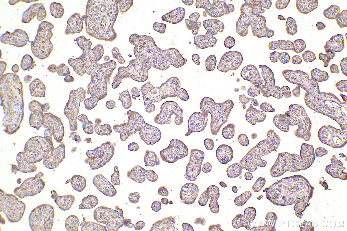 Immunohistochemical analysis of paraffin-embedded human placenta tissue slide using KHC2484 (RAB35 IHC Kit).