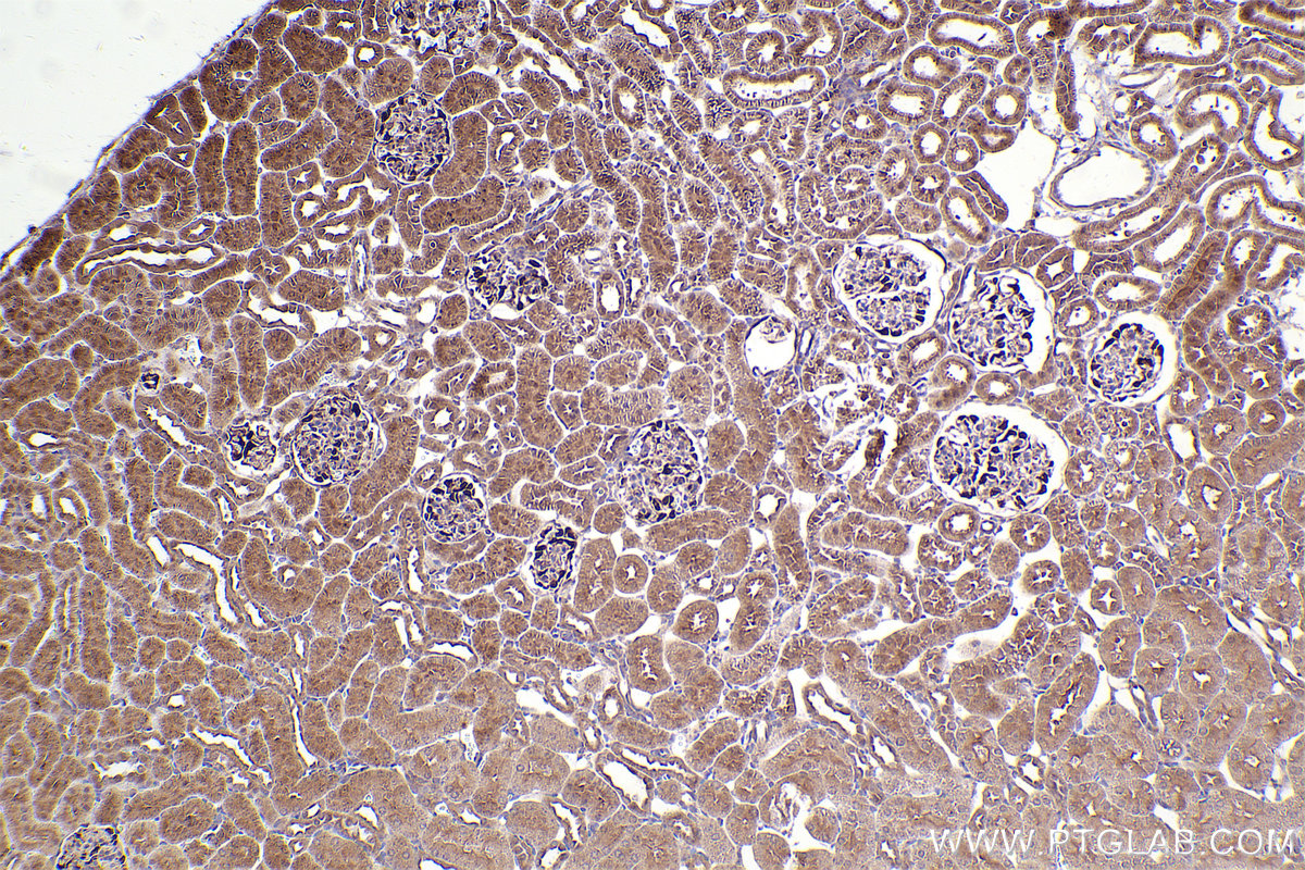 Immunohistochemical analysis of paraffin-embedded rat kidney tissue slide using KHC2484 (RAB35 IHC Kit).