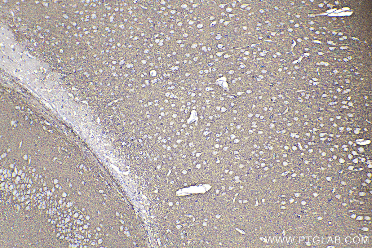 Immunohistochemical analysis of paraffin-embedded mouse brain tissue slide using KHC2201 (RAB3A IHC Kit).