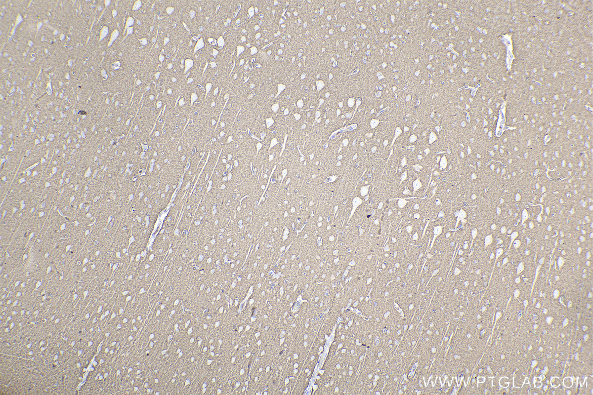 Immunohistochemical analysis of paraffin-embedded rat brain tissue slide using KHC2201 (RAB3A IHC Kit).