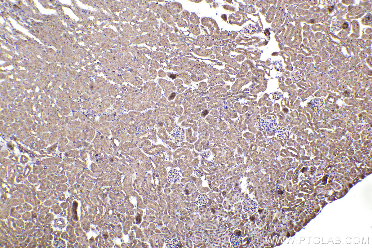 Immunohistochemical analysis of paraffin-embedded mouse kidney tissue slide using KHC2301 (RAB9A IHC Kit).