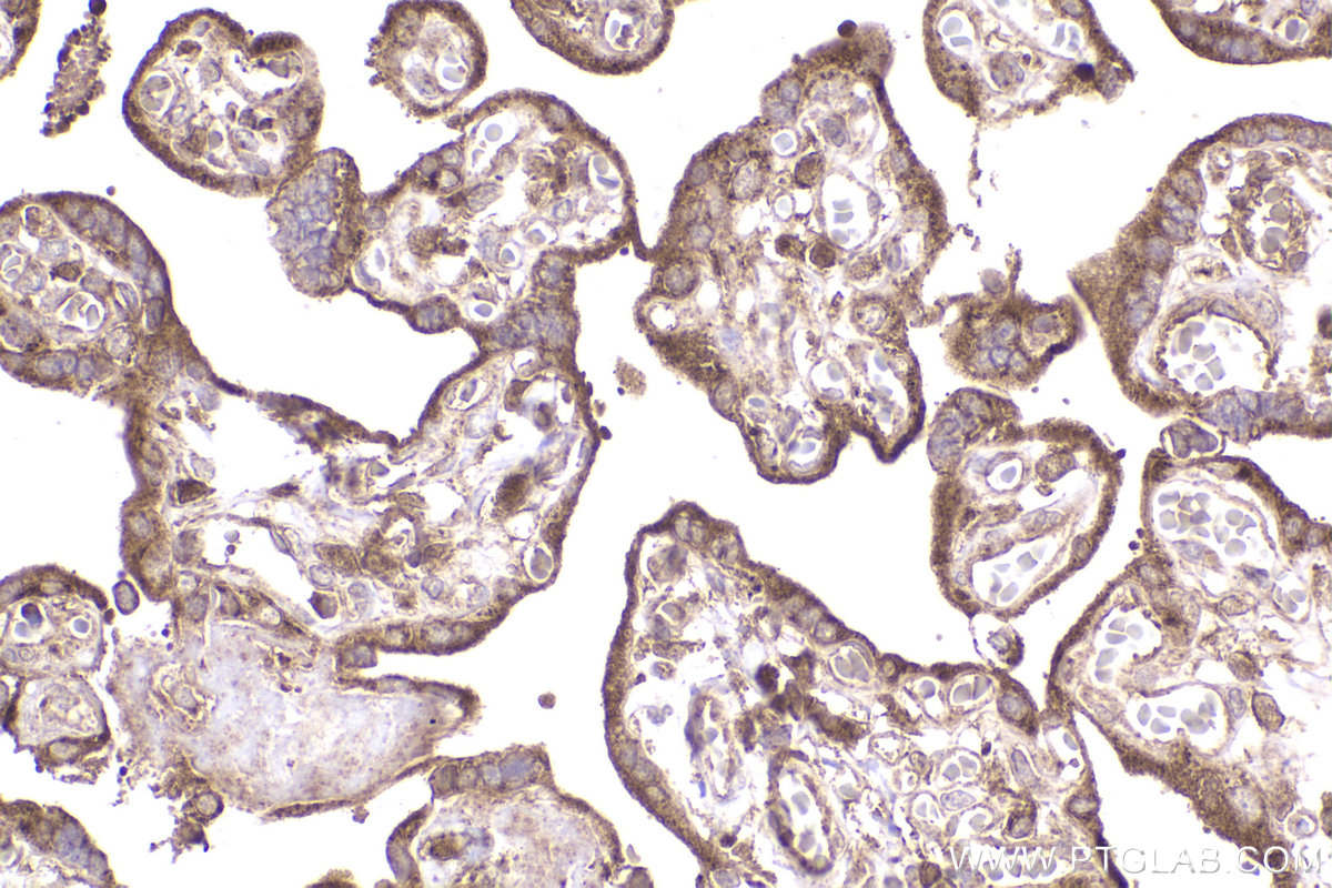 Immunohistochemical analysis of paraffin-embedded human placenta tissue slide using KHC2301 (RAB9A IHC Kit).