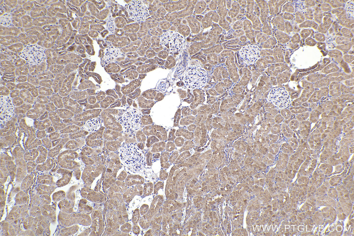 Immunohistochemical analysis of paraffin-embedded rat kidney tissue slide using KHC2301 (RAB9A IHC Kit).