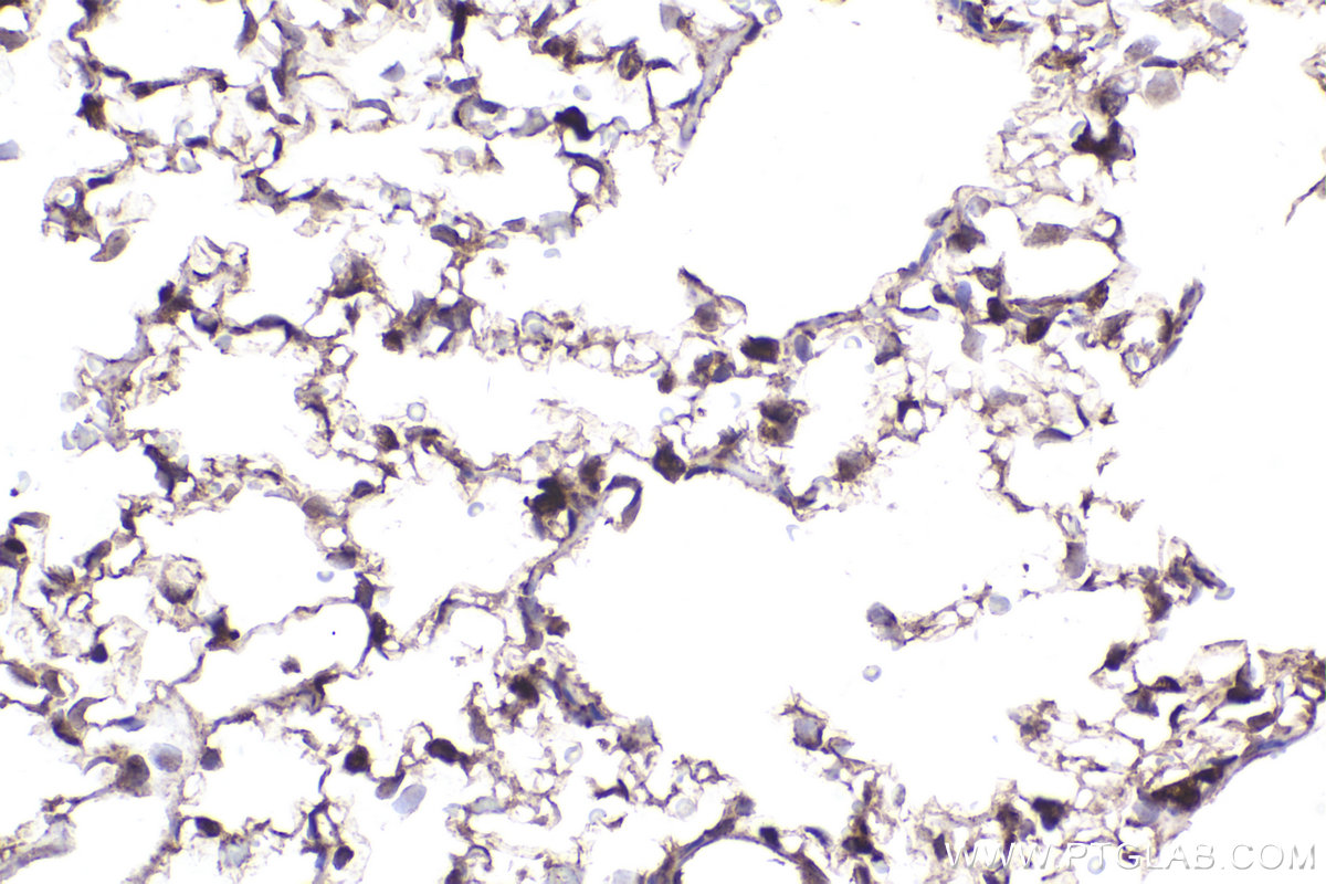 Immunohistochemical analysis of paraffin-embedded rat lung tissue slide using KHC2301 (RAB9A IHC Kit).