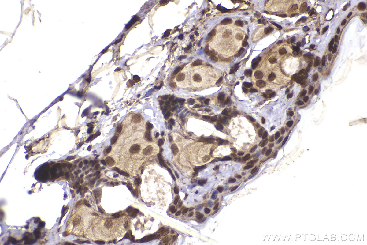 Immunohistochemical analysis of paraffin-embedded mouse skin tissue slide using KHC2356 (RAC1 IHC Kit).