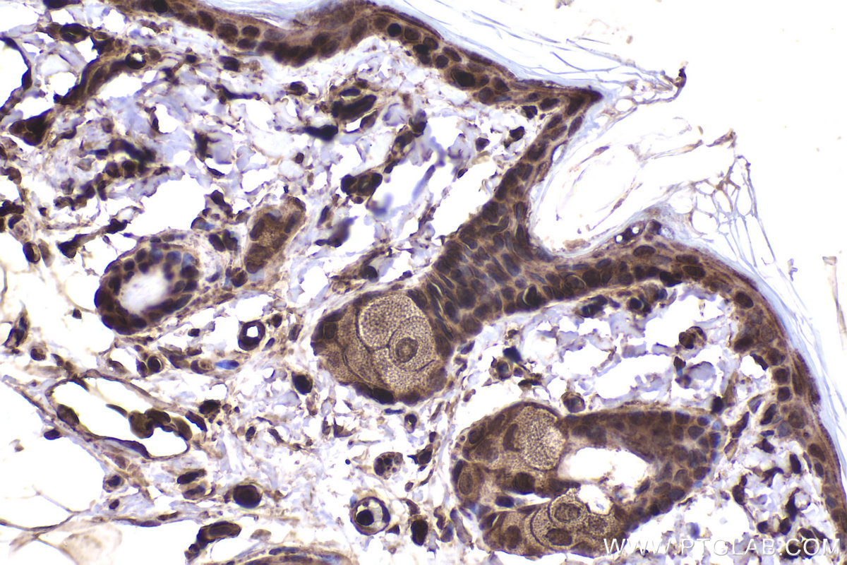 Immunohistochemical analysis of paraffin-embedded rat skin tissue slide using KHC2356 (RAC1 IHC Kit).