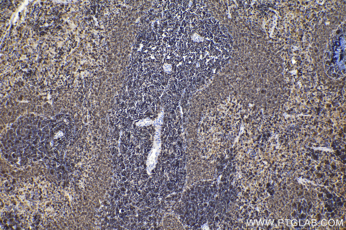 Immunohistochemical analysis of paraffin-embedded rat spleen tissue slide using KHC2189 (RAC2 IHC Kit).