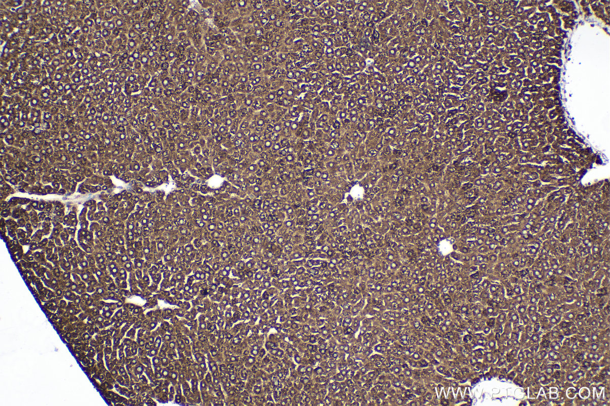 Immunohistochemical analysis of paraffin-embedded mouse liver tissue slide using KHC2361 (RACK1 IHC Kit).