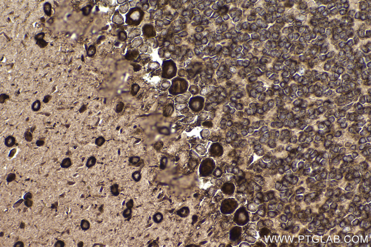 Immunohistochemical analysis of paraffin-embedded mouse cerebellum tissue slide using KHC2361 (RACK1 IHC Kit).