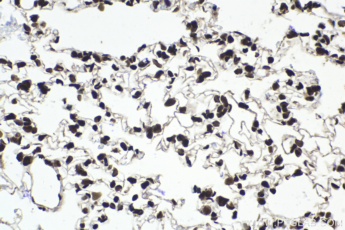 Immunohistochemical analysis of paraffin-embedded rat lung tissue slide using KHC2094 (RAD21 IHC Kit).