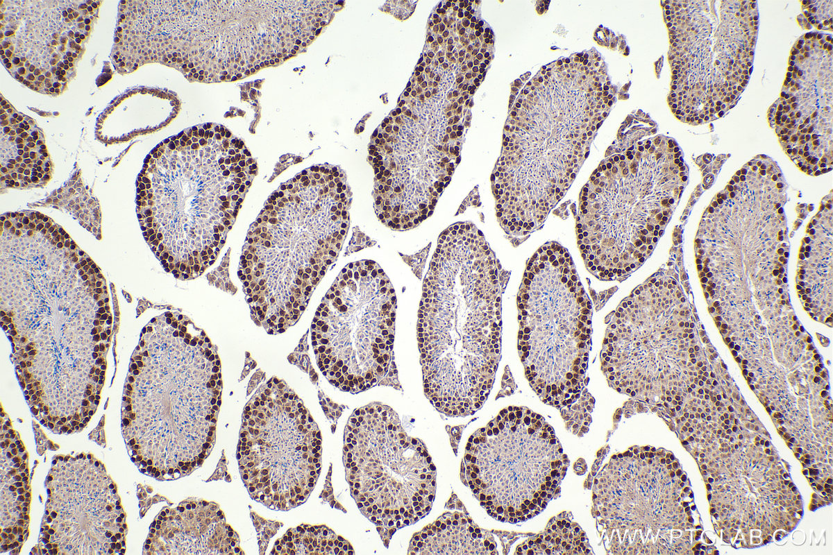 Immunohistochemical analysis of paraffin-embedded mouse testis tissue slide using KHC2396 (RAD51 IHC Kit).