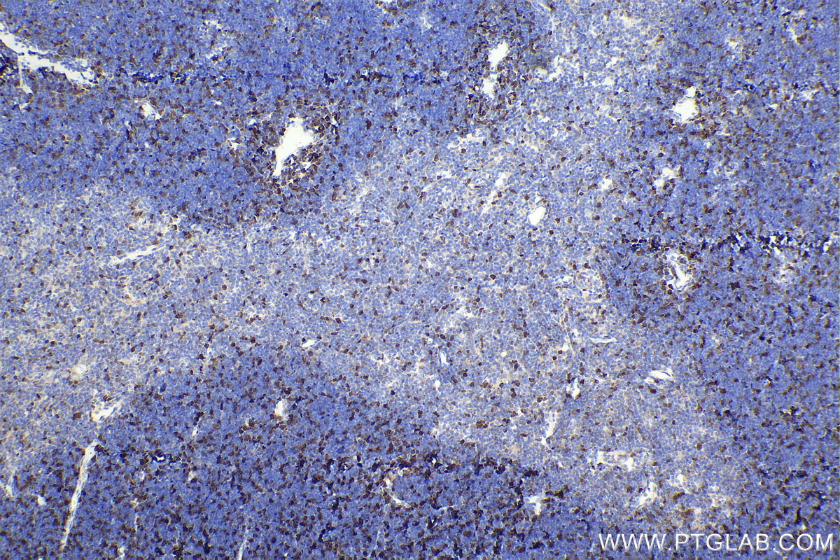 Immunohistochemical analysis of paraffin-embedded rat thymus tissue slide using KHC2396 (RAD51 IHC Kit).