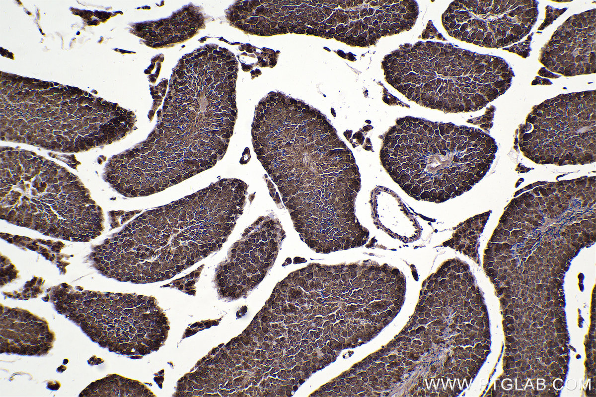 Immunohistochemical analysis of paraffin-embedded mouse testis tissue slide using KHC2353 (RAN IHC Kit).