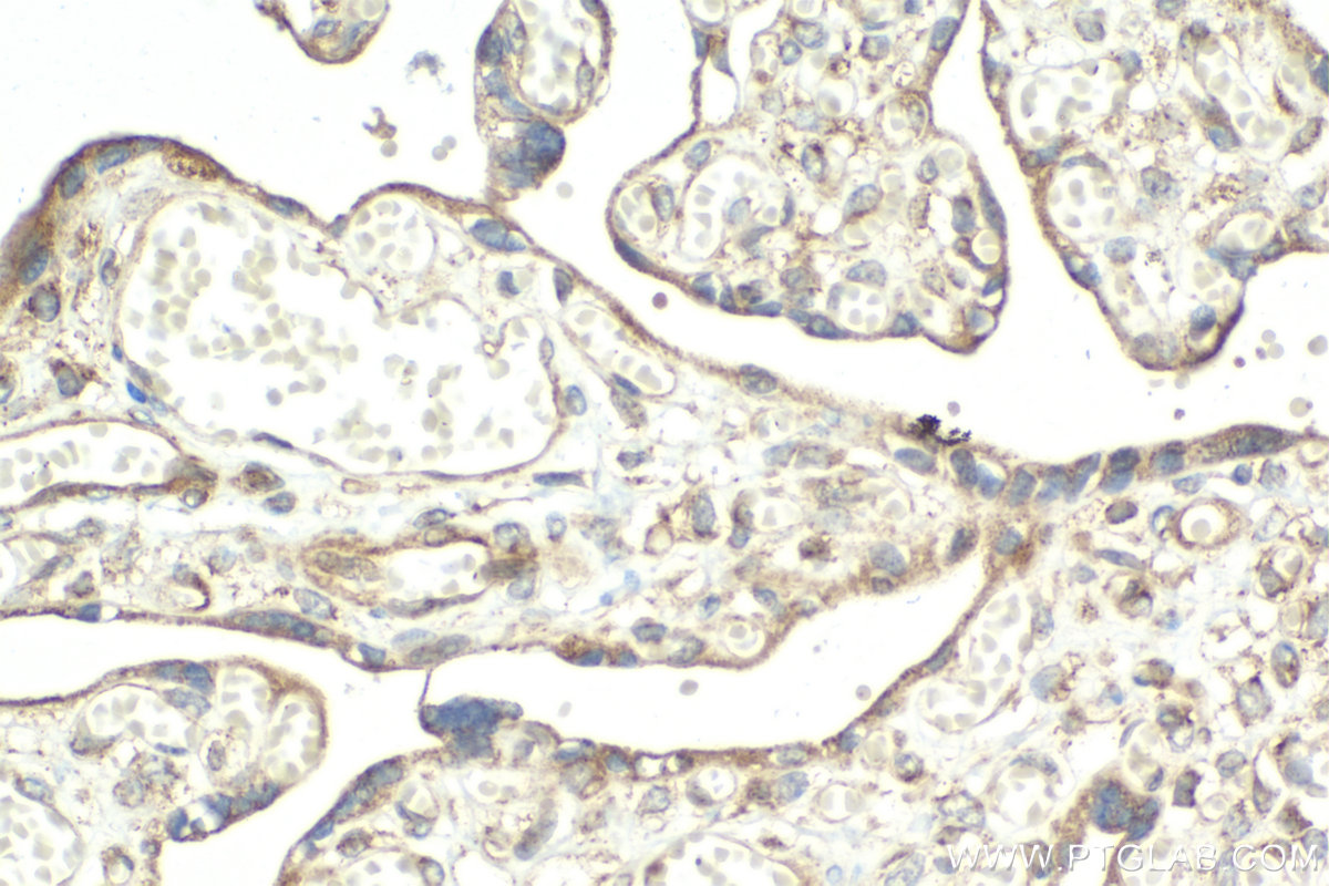 Immunohistochemical analysis of paraffin-embedded human placenta tissue slide using KHC2057 (RASGRF2 IHC Kit).