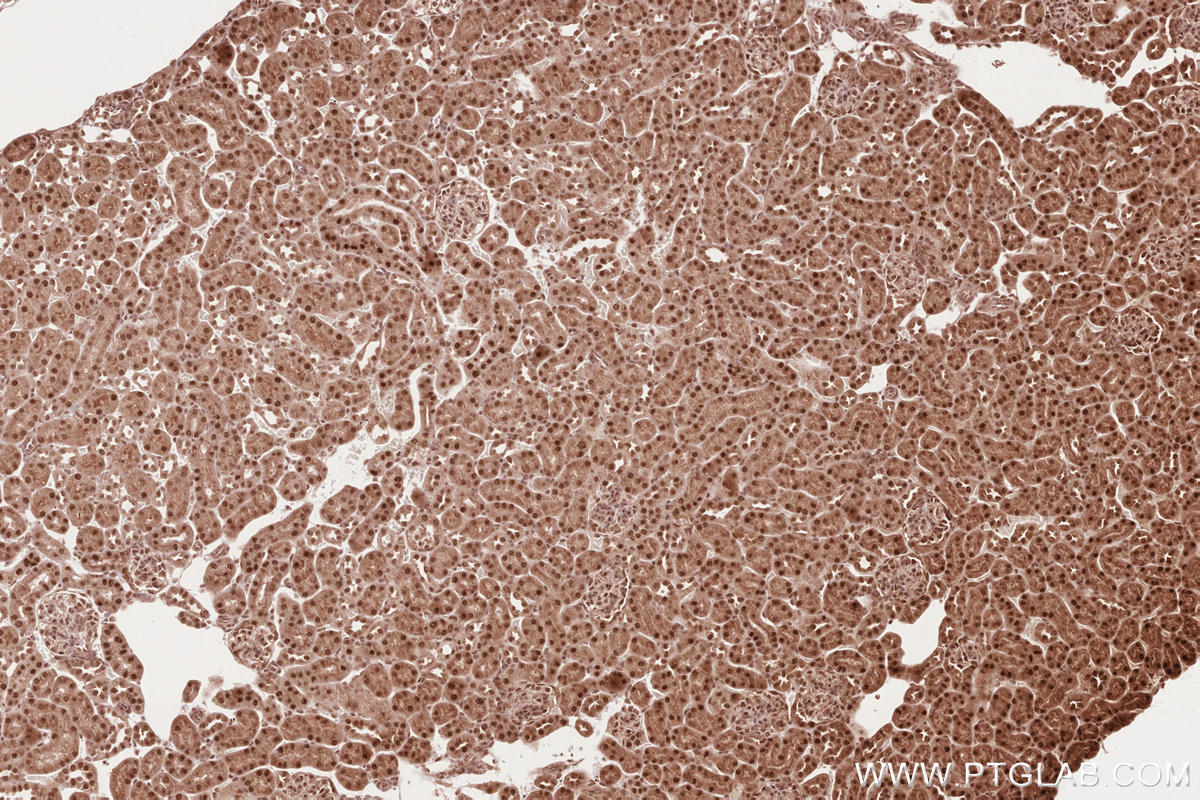 Immunohistochemical analysis of paraffin-embedded mouse kidney tissue slide using KHC2624 (RBBP6 IHC Kit).