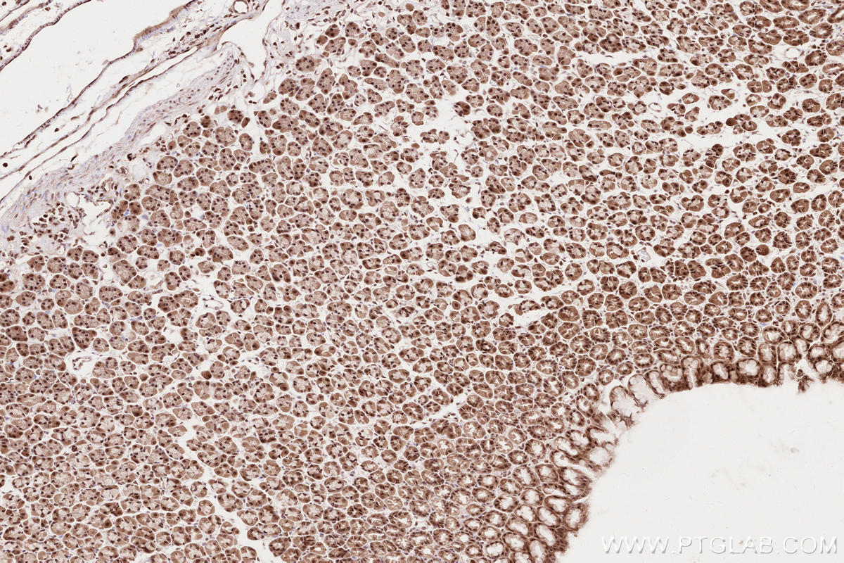 Immunohistochemical analysis of paraffin-embedded rat stomach tissue slide using KHC2624 (RBBP6 IHC Kit).