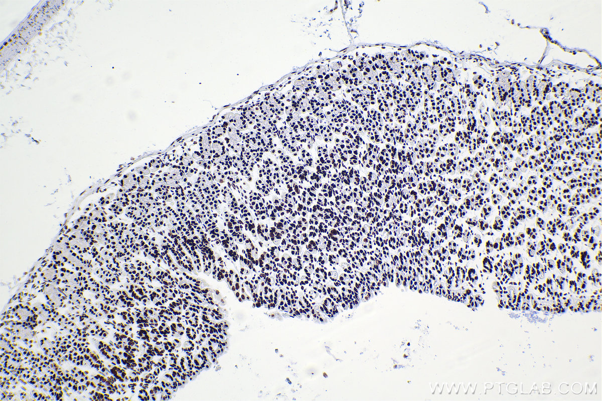 Immunohistochemical analysis of paraffin-embedded mouse stomach tissue slide using KHC2378 (RBM10 IHC Kit).