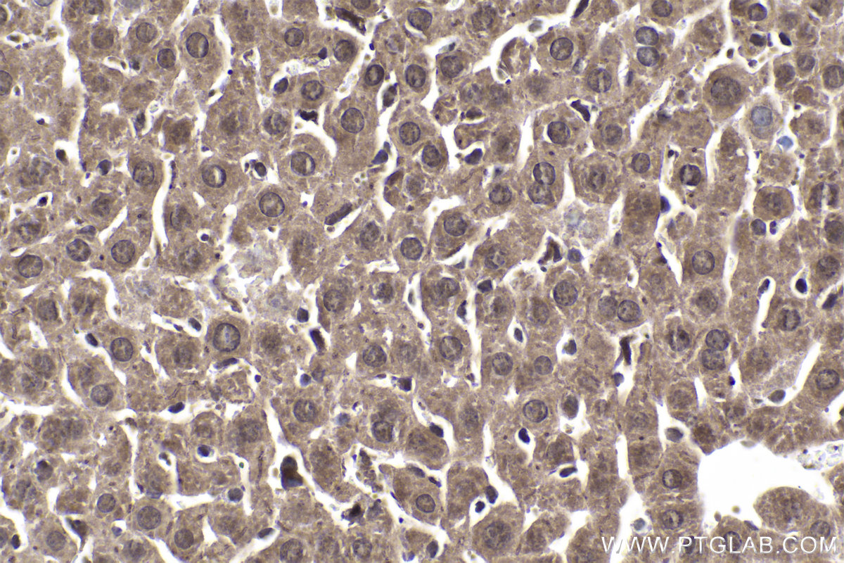 Immunohistochemical analysis of paraffin-embedded mouse liver tissue slide using KHC1933 (RGC32 IHC Kit).