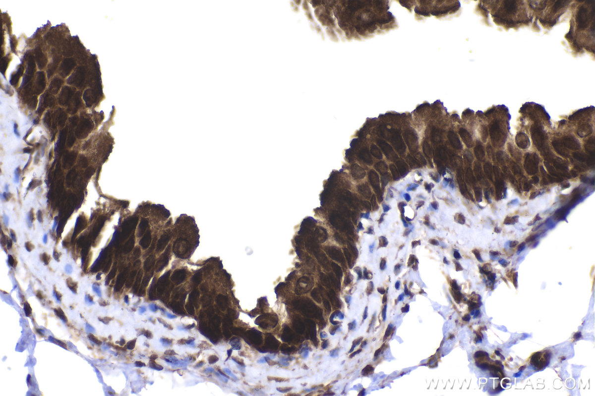 Immunohistochemical analysis of paraffin-embedded rat bladder tissue slide using KHC2258 (RGS2 IHC Kit).